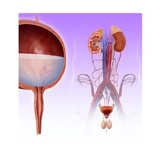 慢性尿潴留