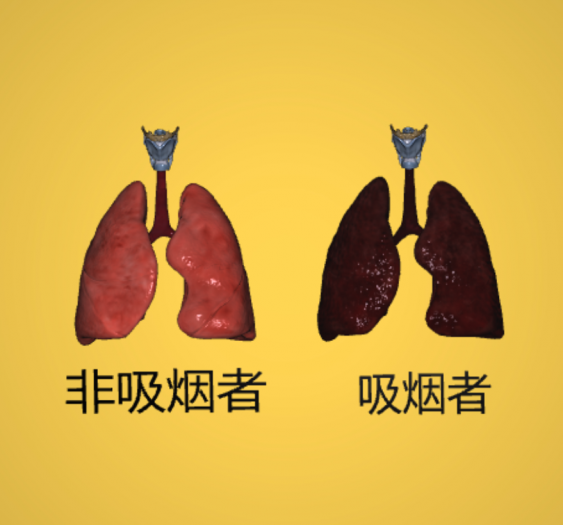 吸烟者的肺与非吸烟者的肺