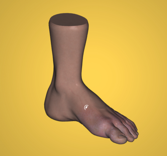 足癣Athlete's foot