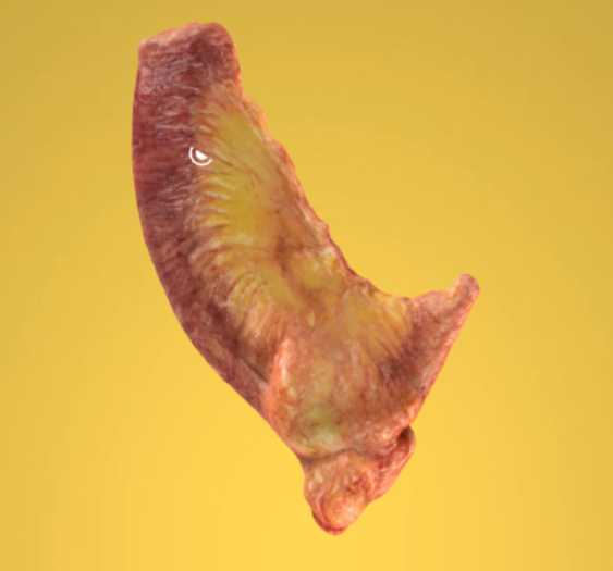 小肠和回肠淋巴肉瘤