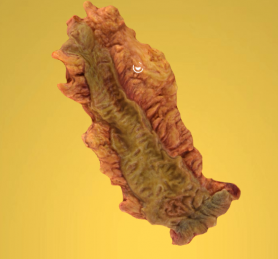 直肠腺癌