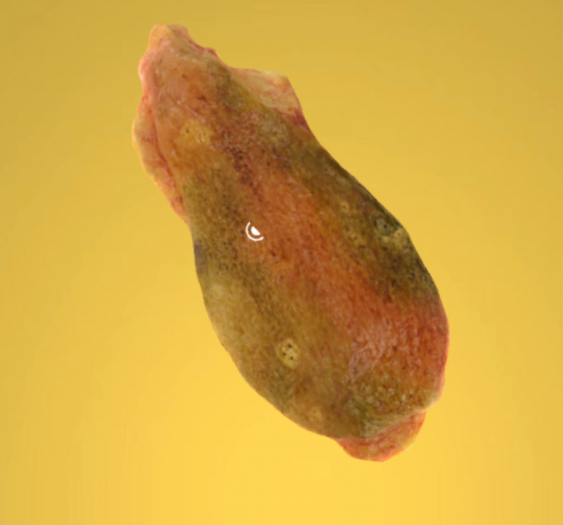 有胆汁的胆囊