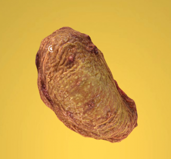 胃息肉Stomach Polyps