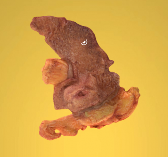 胃平滑肌肉瘤